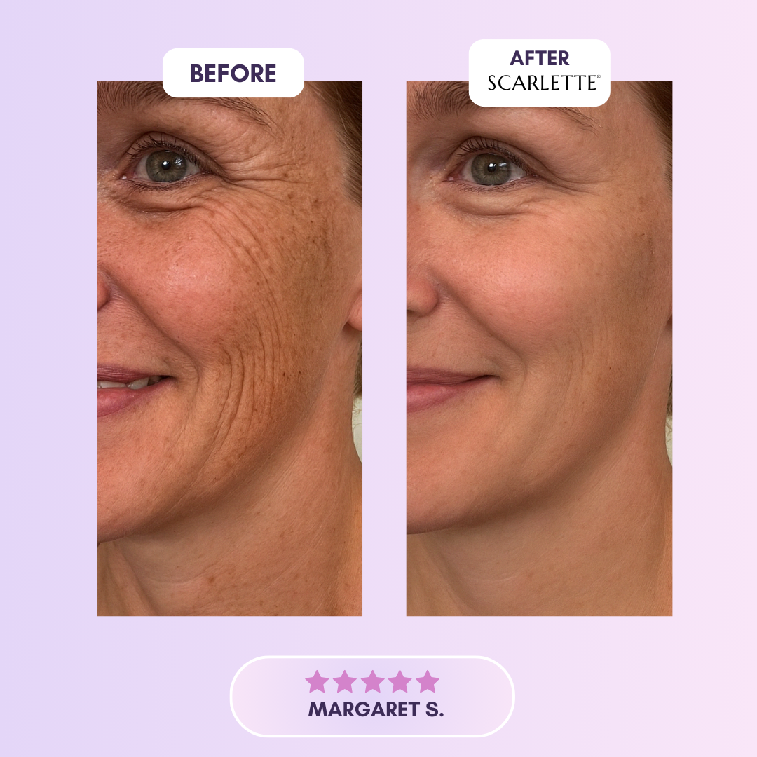 Scarlette™ Silicone Collagen Sheets