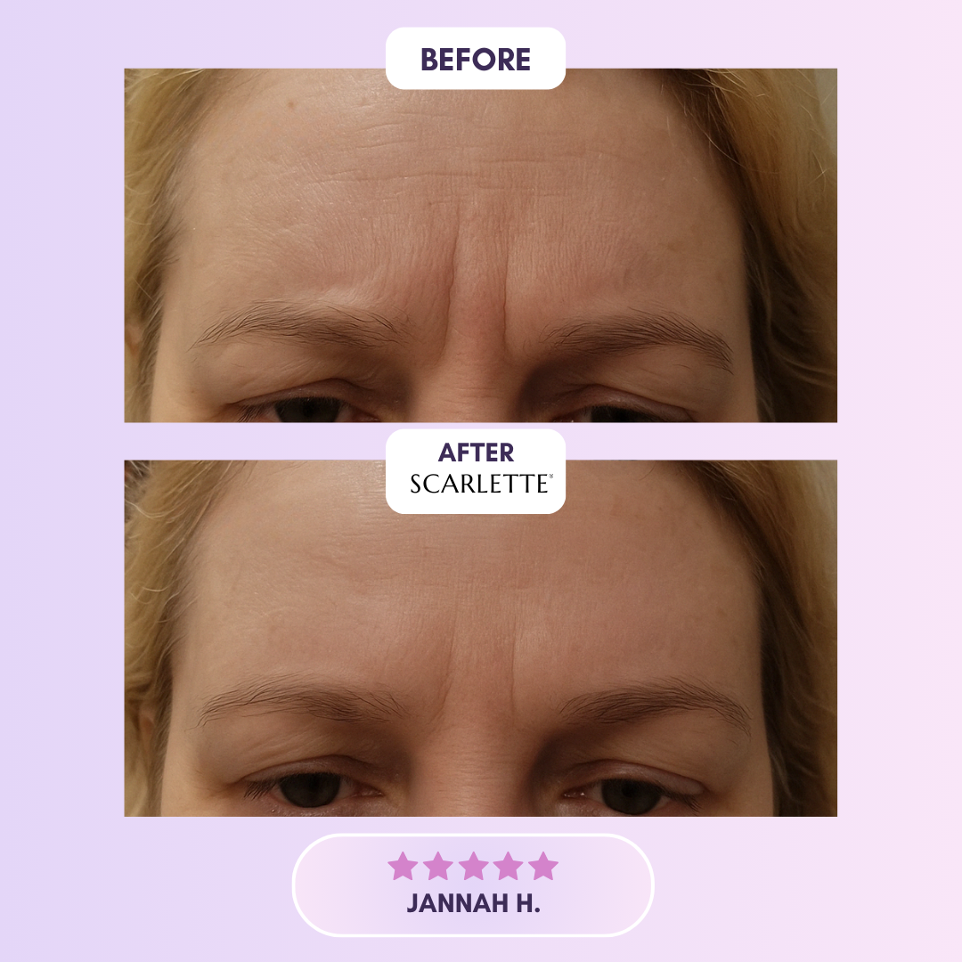 Scarlette™ Silicone Collagen Sheets